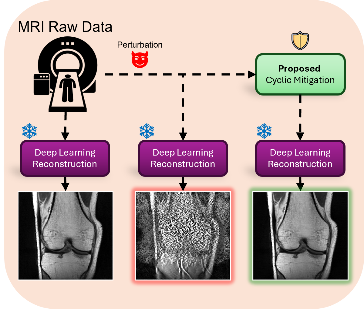 Training-Free Adversarial Robustness in Computational MRI