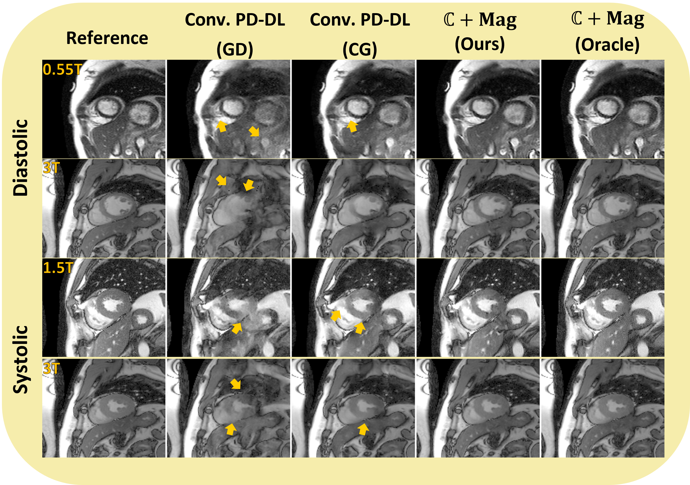 Revisiting MRI Reconstruction Using a Combination of Complex and Magnitude Measurements with Learned Priors