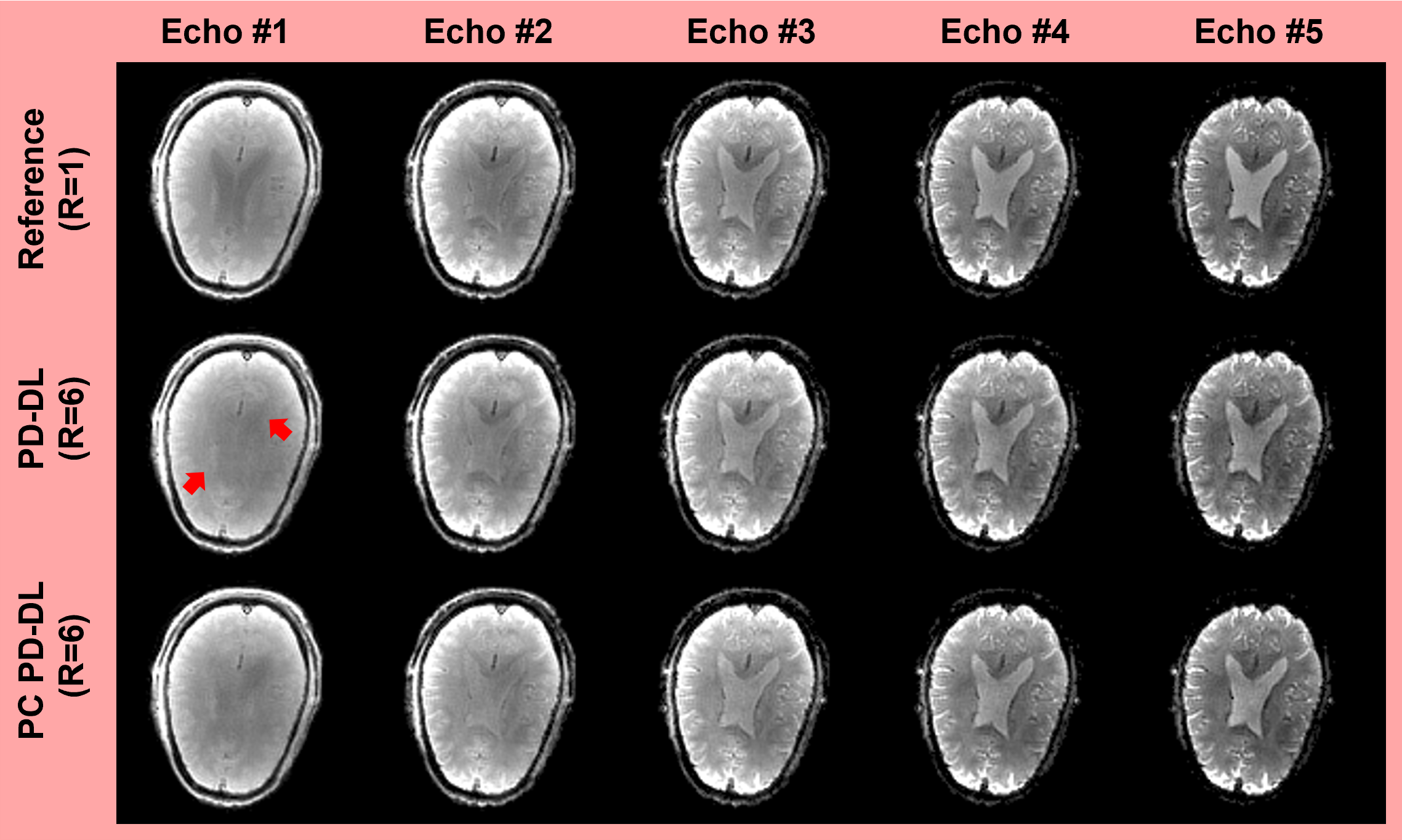 Phase-Crrected Physics-Driven Deep Learning MRI Reconstruction on Non-Cartesian Multi-Echo MRI