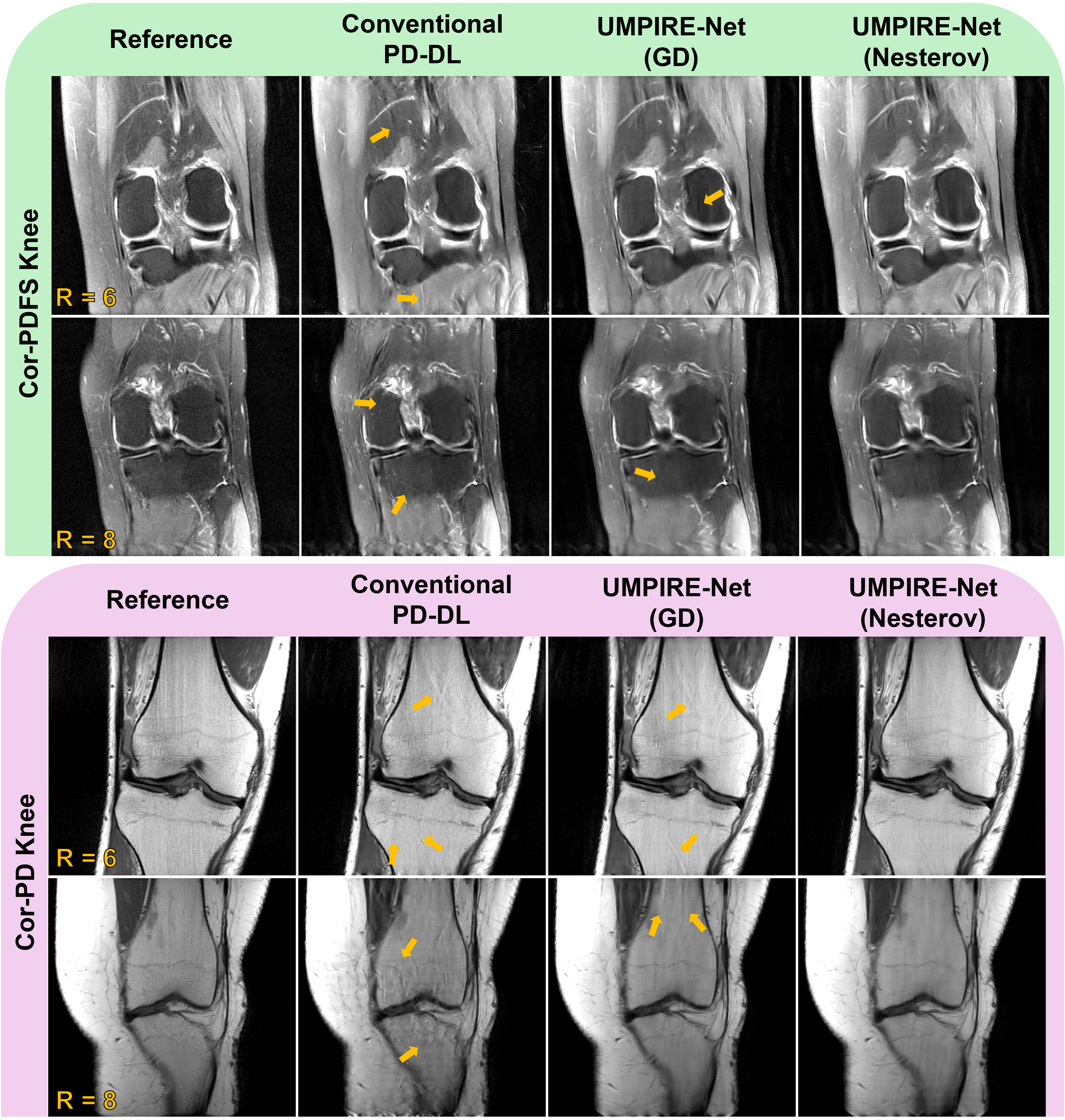 UMPIRE-Net: Unrolled Magnitude–Phase Regularization Network for Accelerated MRI
